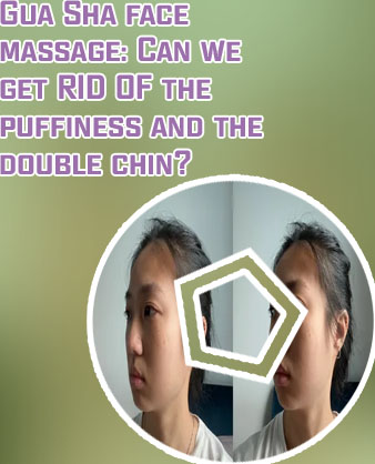 Gua sha double chin before and after